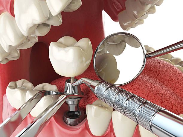 Emergency Dentist Open Today in NJ